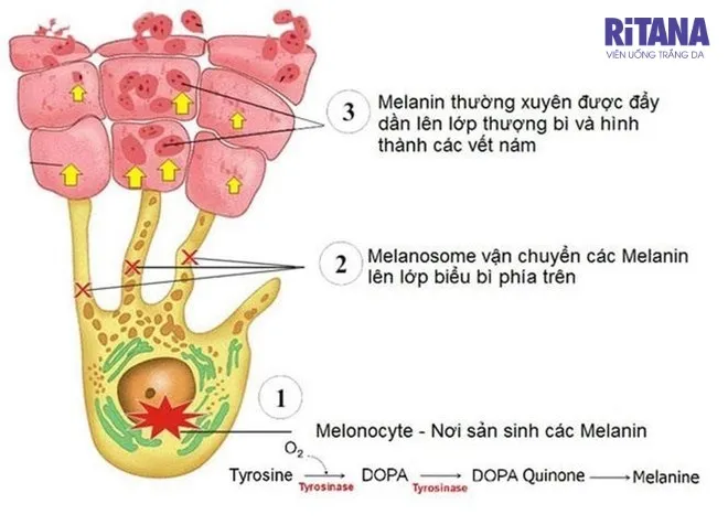 cách làm giảm sắc tố melanin