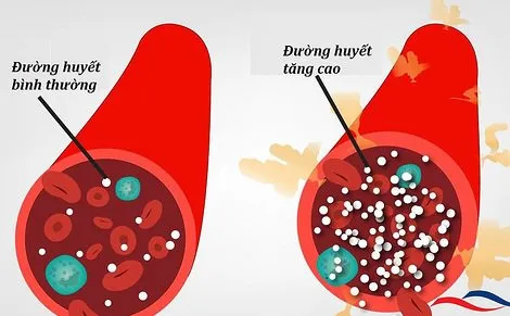 Đường huyết trong máu liên tục thay đổi và chịu sự chi phối của hoạt động ăn uống