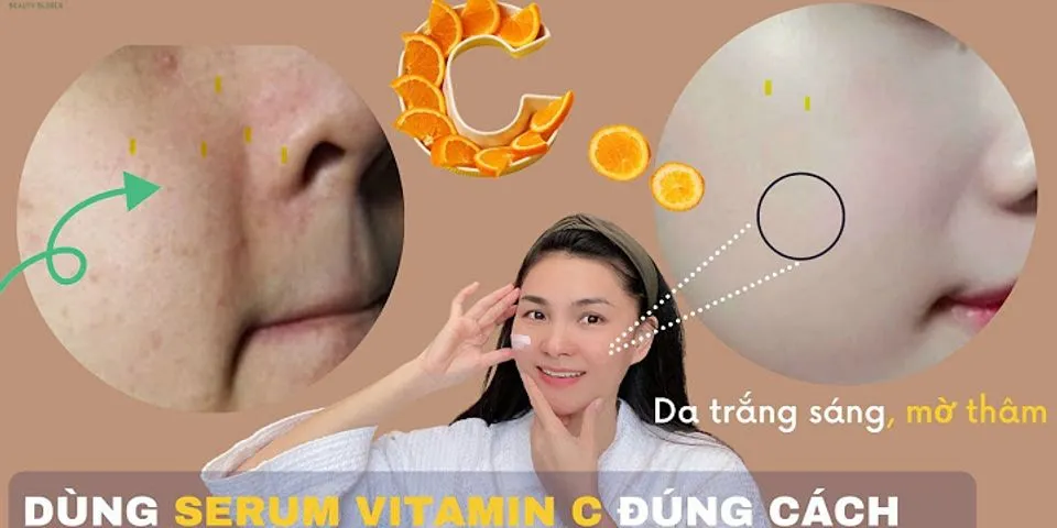 Da khô có nên dụng vitamin C