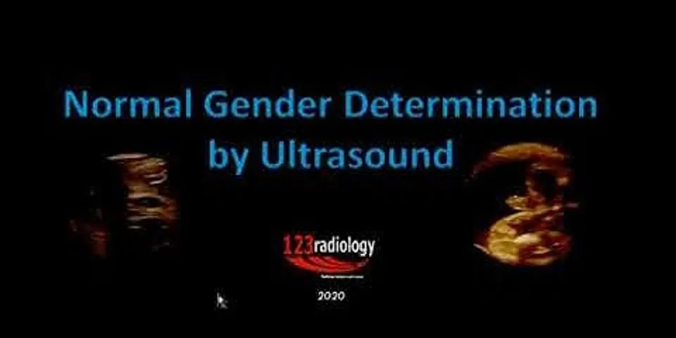 Hình ảnh siêu âm bộ phận sinh dục thai nhi